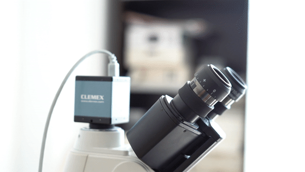 Terapia mRNA e ripristino del cuore